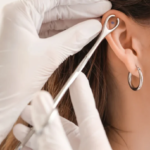 is a lobotomy piercing real