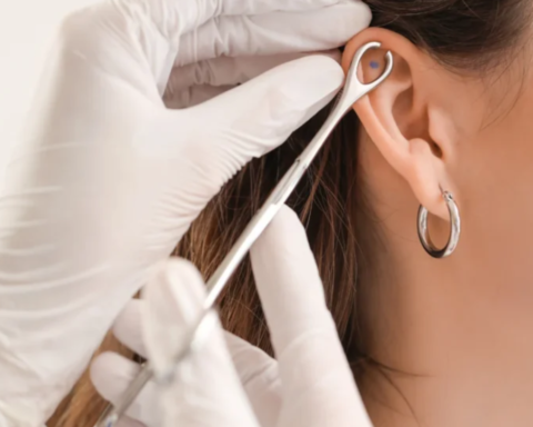 is a lobotomy piercing real