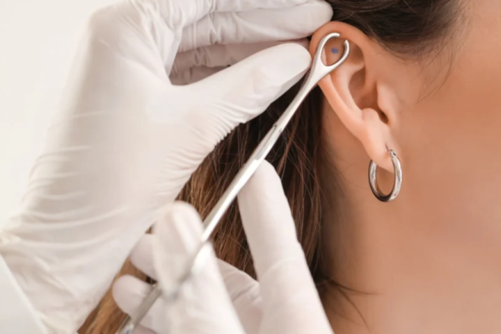 is a lobotomy piercing real