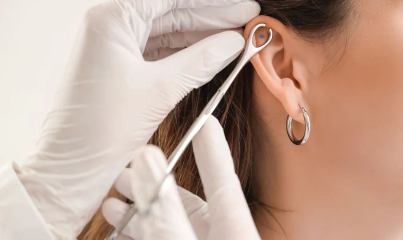 is a lobotomy piercing real